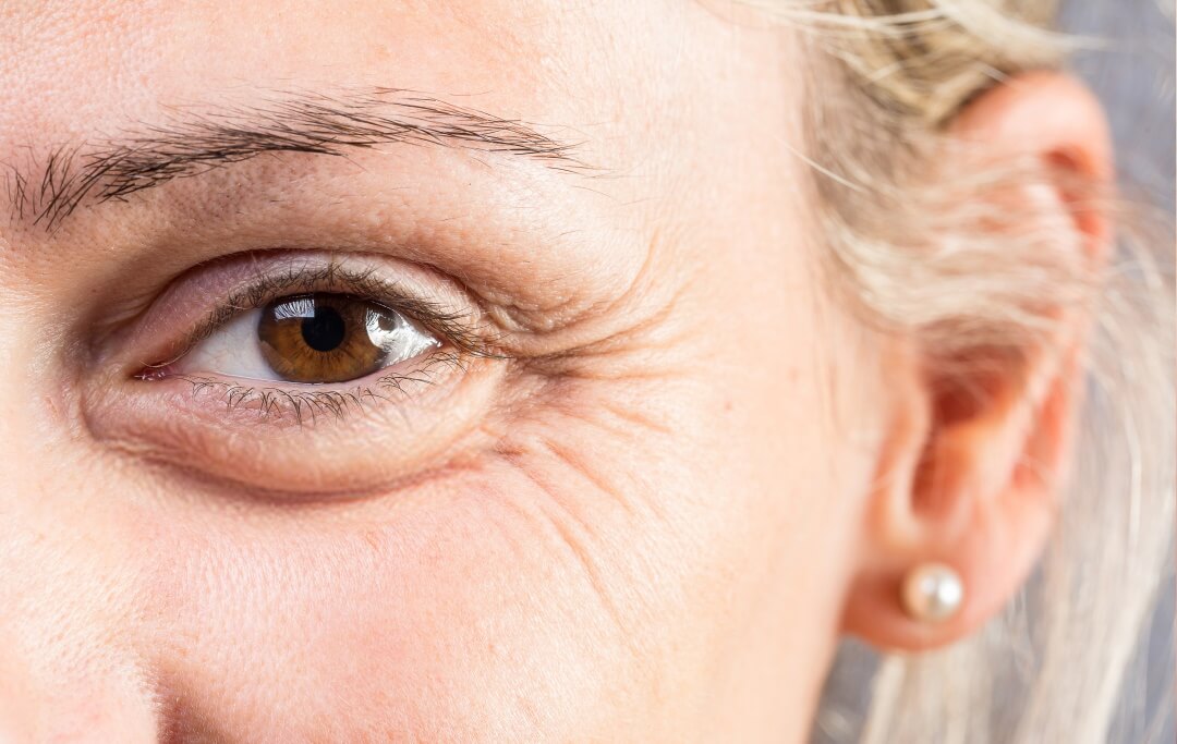 Nahaufnahme von den Falten um das Auge einer Frau