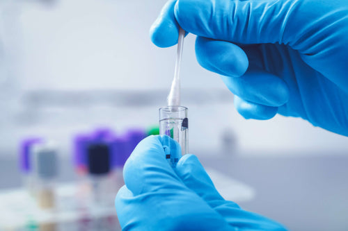 Stoffwechselanalyse – richtig ernähren dank DNA-Test?