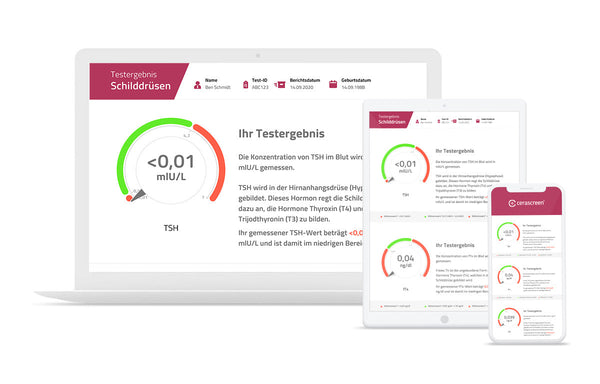 Vorschau des Testergebnisses des Schilddrüsen Tests von cerascreen