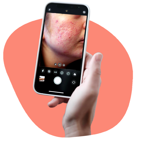 dermanostic - Hautarzt per App
